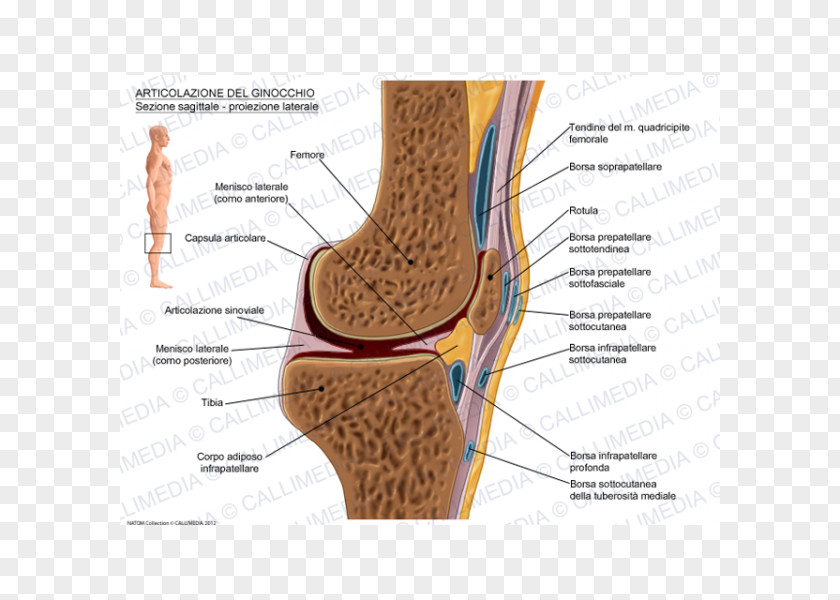 Prepatellar Bursitis Infrapatellar Synovial Bursa Knee PNG