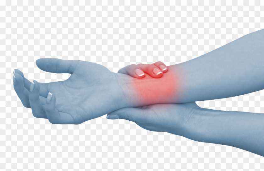 Pain Wrist Hand Carpal Tunnel Syndrome Sprain PNG