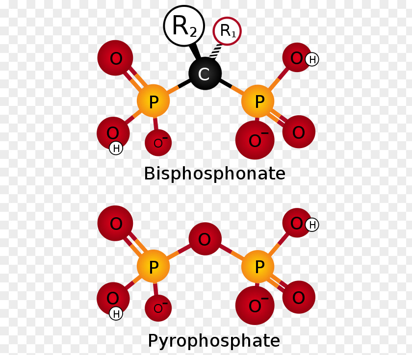 Bisphosphonate Ibandronic Acid Pyrophosphate Pharmaceutical Drug Osteoporosis PNG
