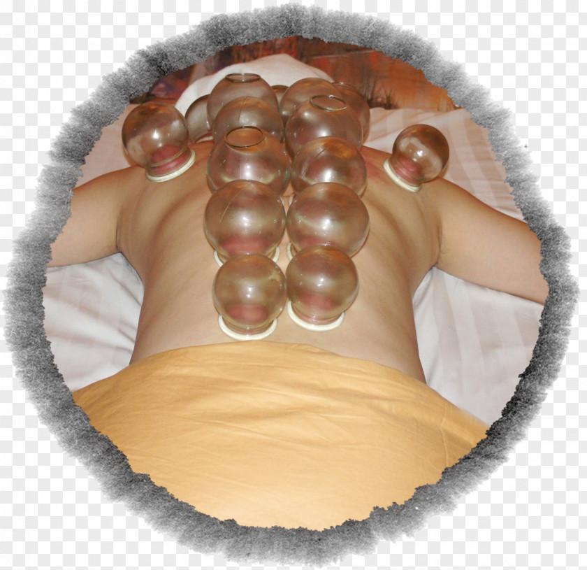 Cupping Health Culture Therapy Running Fitness PNG