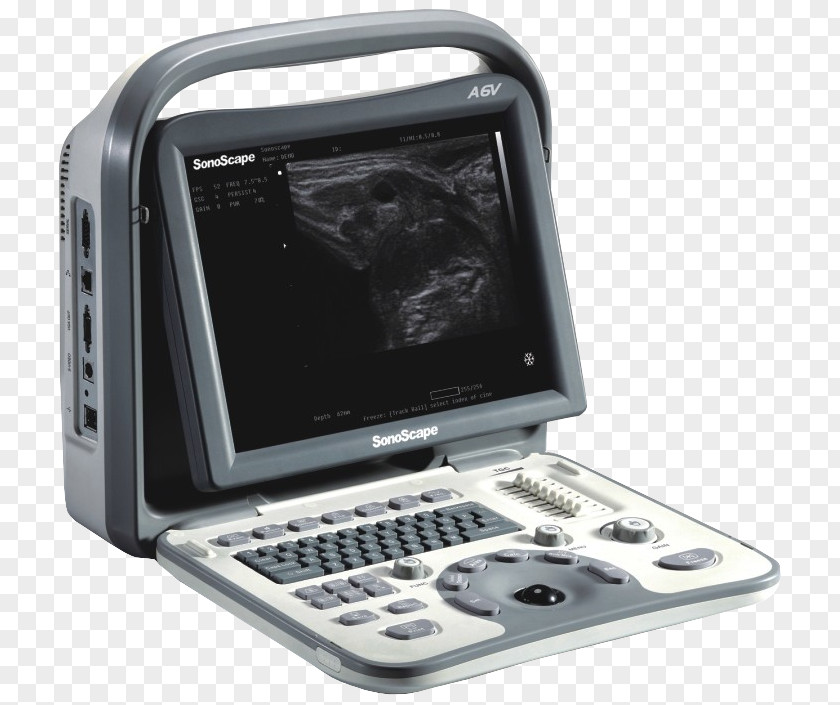 Ultrasound Portable Ultrasonography Doppler Echocardiography Medical Diagnosis PNG
