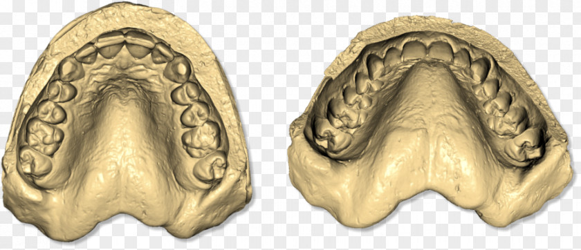 Dental Impression Dentistry Image Scanner Implant Tooth PNG