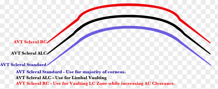 Scleral Lens Contact Lenses Corneal Limbus PNG