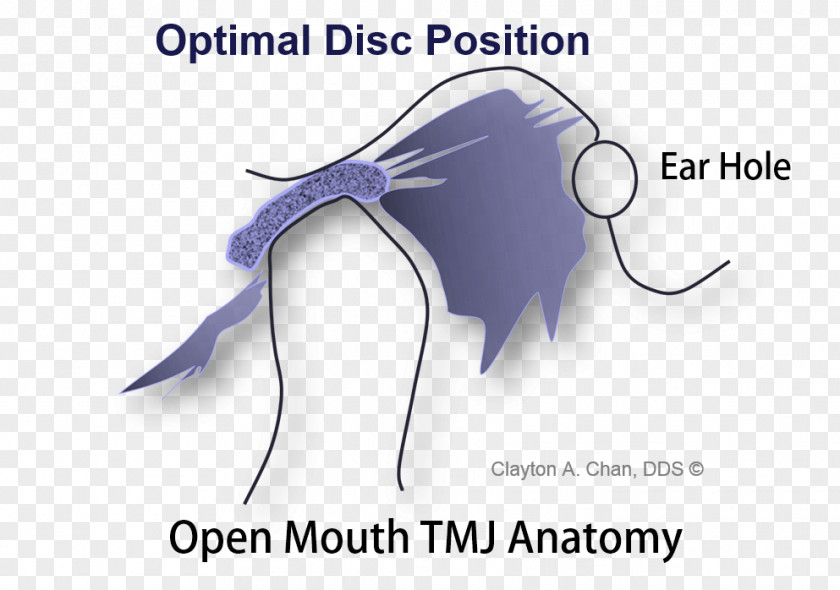 Skull Temporomandibular Joint Dysfunction Anatomy Mandible PNG