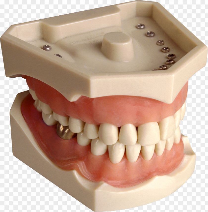Steel Teeth Jaw Mandible Maxilla Tooth Gums PNG