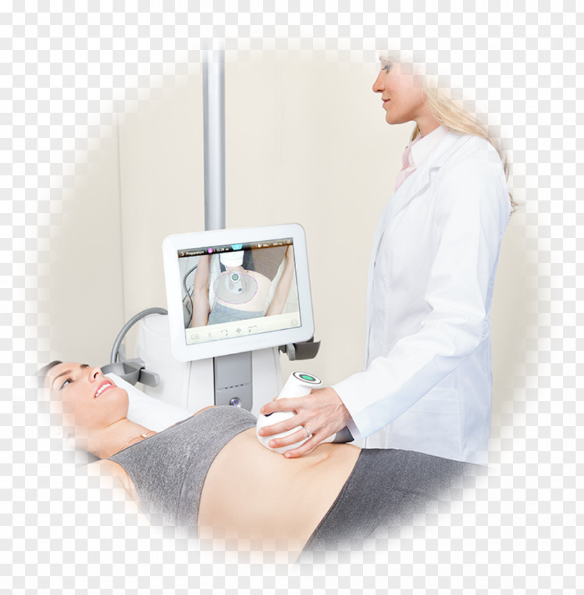 Fat Reduction Exercise Therapy UltraShape Liposuction High-intensity Focused Ultrasound PNG