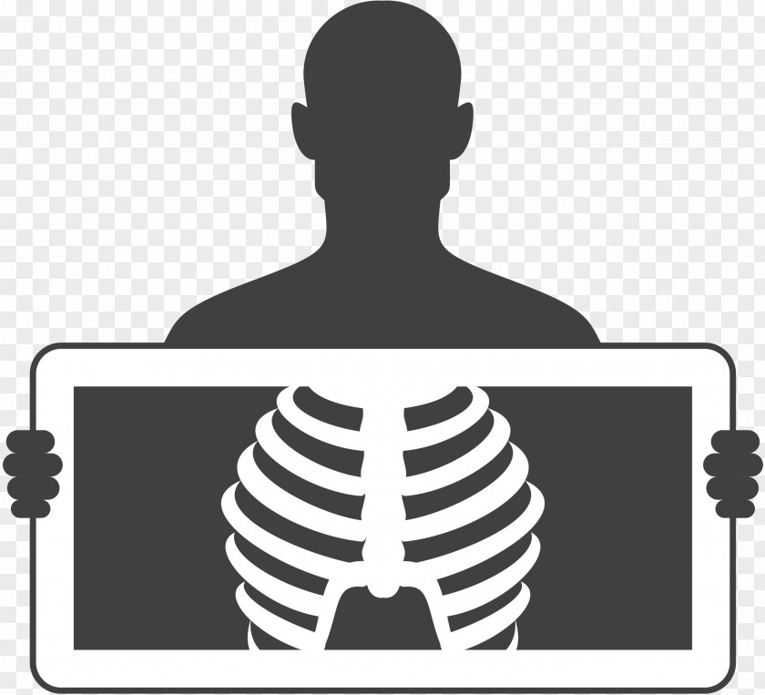 X-ray Medicine Tuberculosis Image Vector Graphics PNG