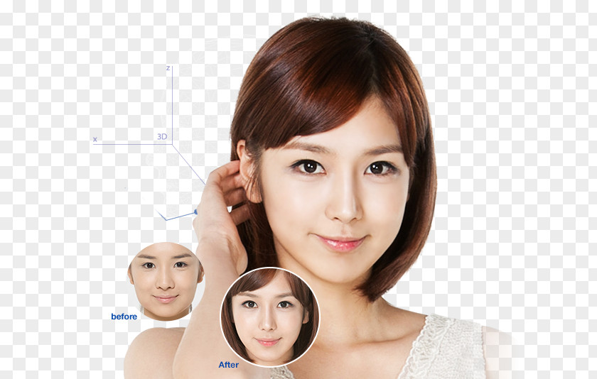Nose Plastic Surgery Ho Chi Minh City Face Chin PNG
