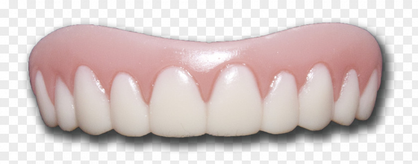 Teeth Transparent Images Veneer Tooth Whitening Dentures Pathology PNG