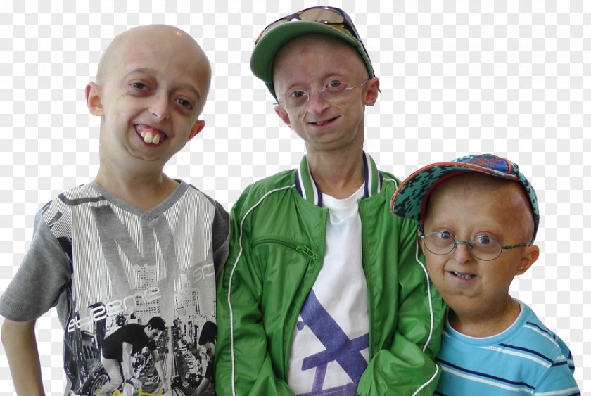 College Night Progeria Disease Syndrome Child Netherlands PNG