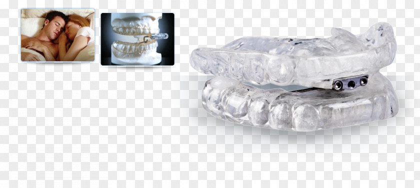 Open An Account Freely Snoring Dentistry Mandibular Advancement Splint Mouthguard PNG