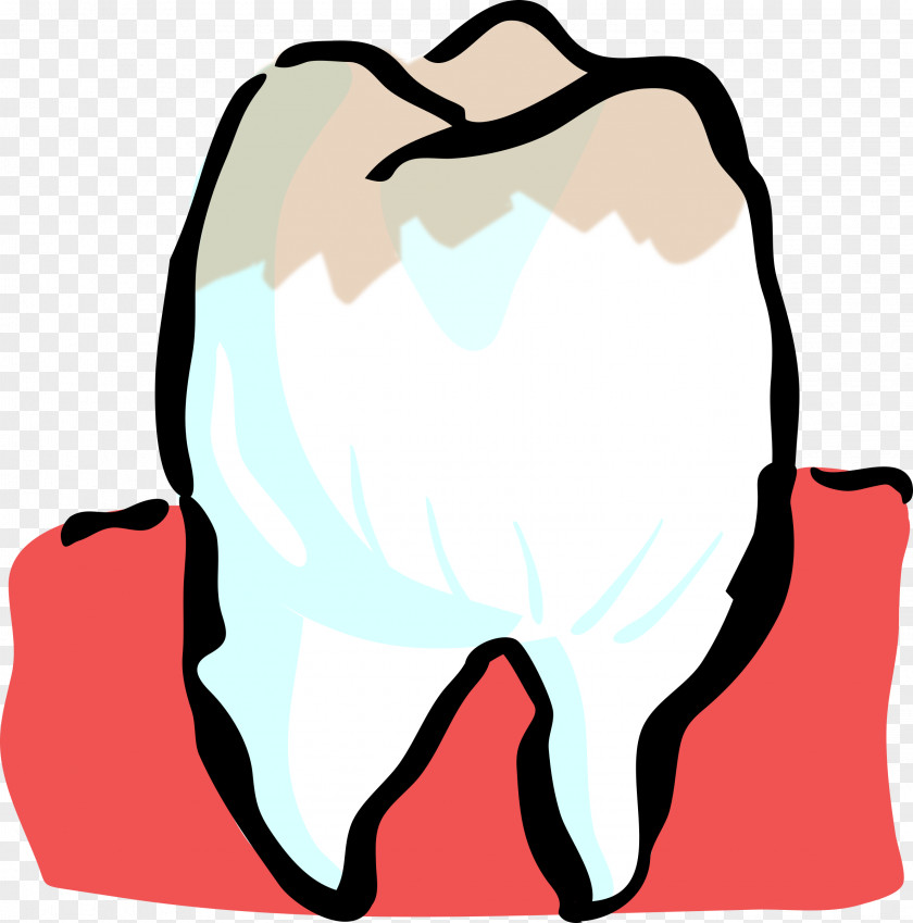 Cavity Human Tooth Dentist Clip Art PNG