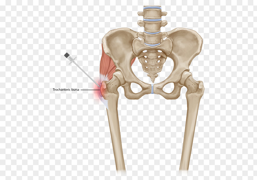Greater Trochanteric Pain Syndrome Low Back Vertebral Column Muscle Pelvis PNG