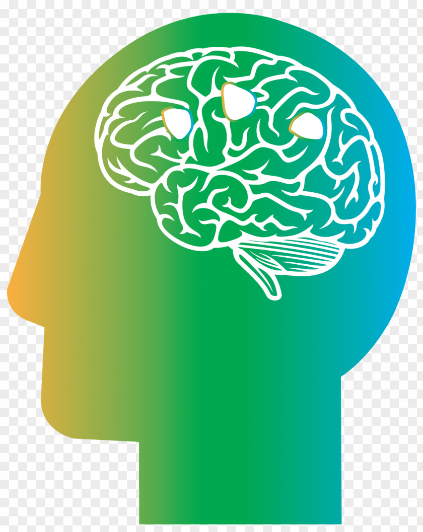 On The Brain Alzheimer's Disease Medicine Health Dementia PNG