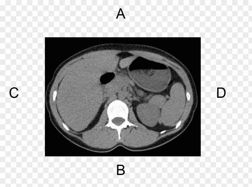 Design Computed Tomography Font PNG