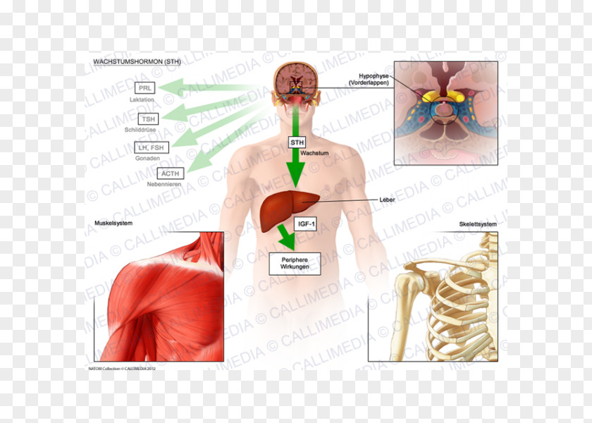 Acromegalia Growth Hormone Pituitary Gland Adrenocorticotropic Development Of The Human Body PNG