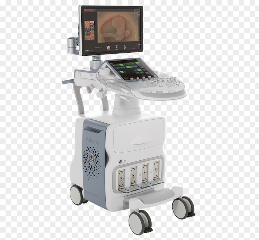 Voluson 730 Ultrasonography GE Healthcare KPI Inc. Ultrasound PNG