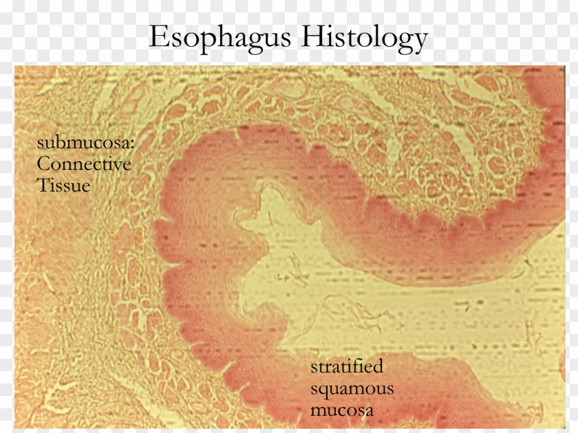 Esophagus Stratified Squamous Epithelium Simple Columnar Histology PNG