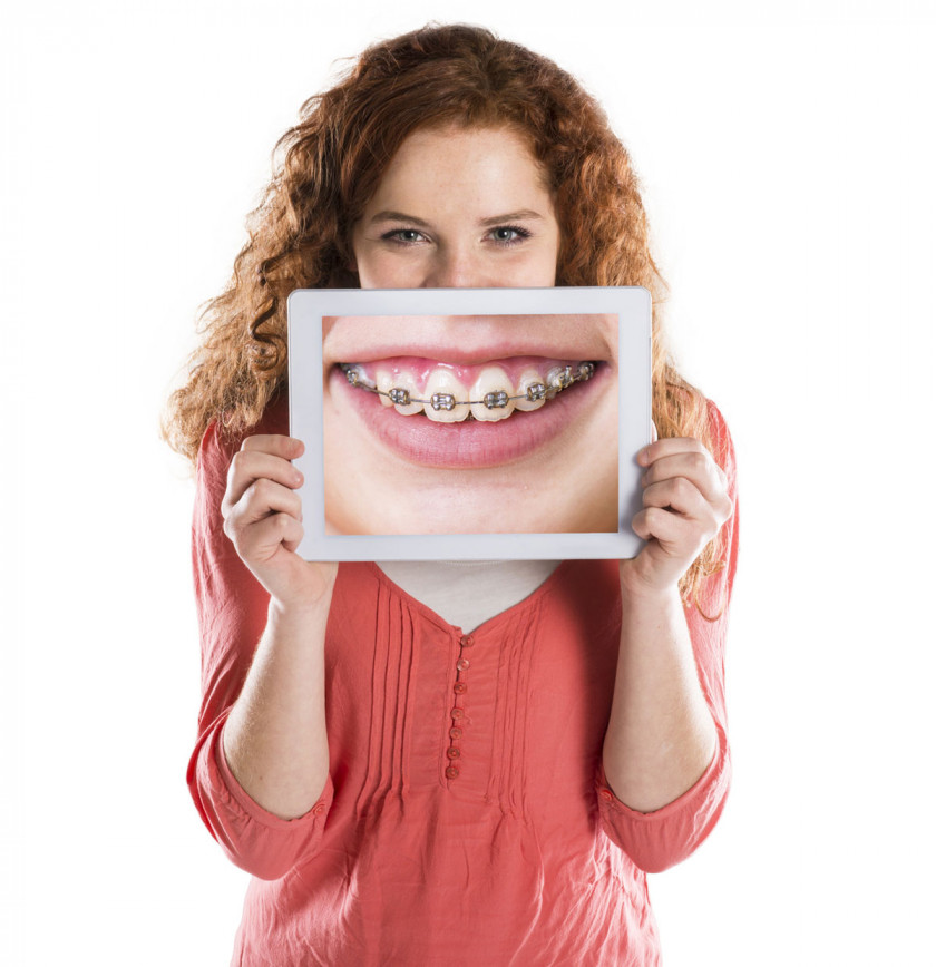 Teeth Dental Braces Dentistry Orthodontics Clear Aligners PNG