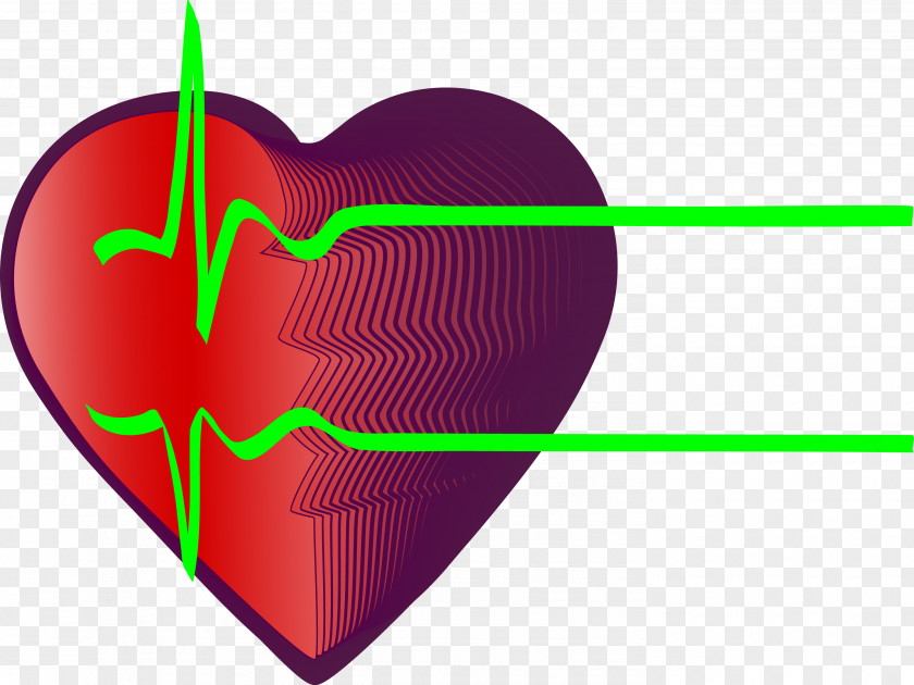 Heart And Green Rate Electrocardiography Myocardial Infarction Coronary Artery Disease PNG