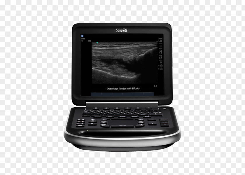 Ultrasound Machine Ultrasonography SonoSite, Inc. Medicine Medical Imaging PNG