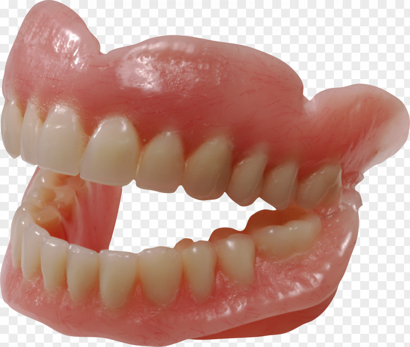 Teeth Image Dentures Dentistry Human Tooth Removable Partial Denture PNG