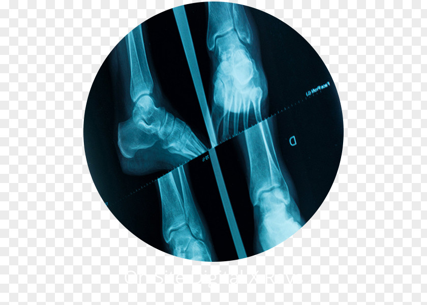 Smithtown Podiatrist Commack X-ray Radiology HauppaugeOthers Sound Foot Care PC PNG