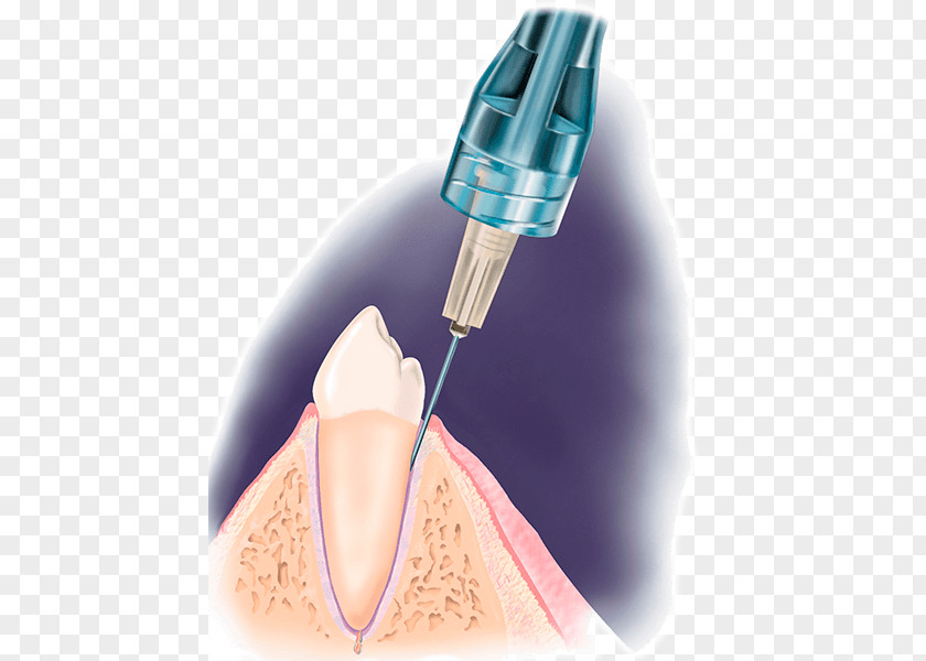 Syringe Dentistry Local Anesthesia Dental Anesthetic PNG