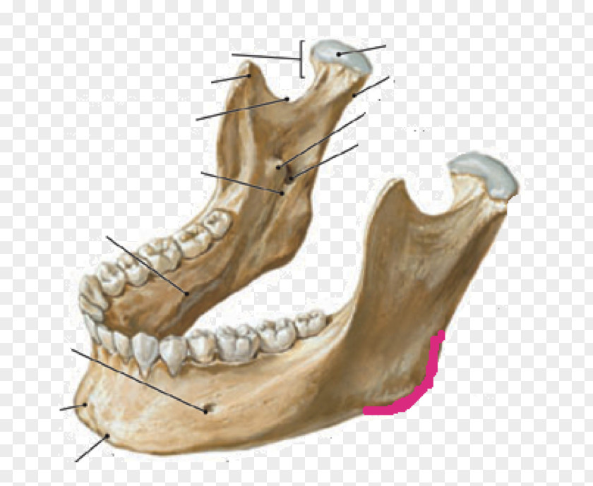 Skull Mandible Anatomy Jaw Infratemporal Fossa PNG
