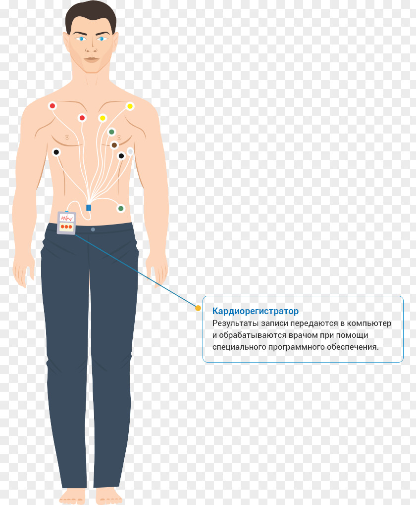 Ekg Holter Monitor Hypertension Electrocardiography Cardiovascular Disease Medical Diagnosis PNG