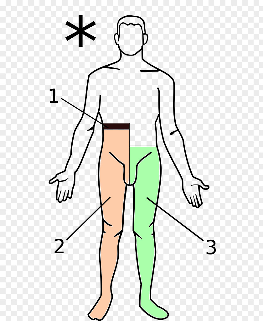 Brown-Séquard Syndrome Spinal Cord Posterior Medicine PNG
