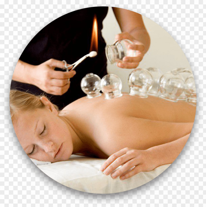 Cupping Therapy Massage Traditional Chinese Medicine Acupuncture PNG