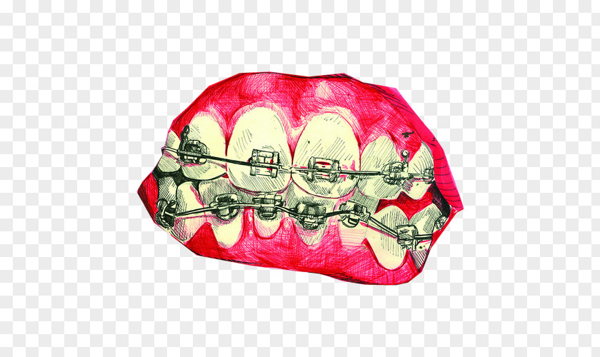 Mouth Tooth Sinful Folk: A Novel Of The Middle Ages Dental Braces PNG