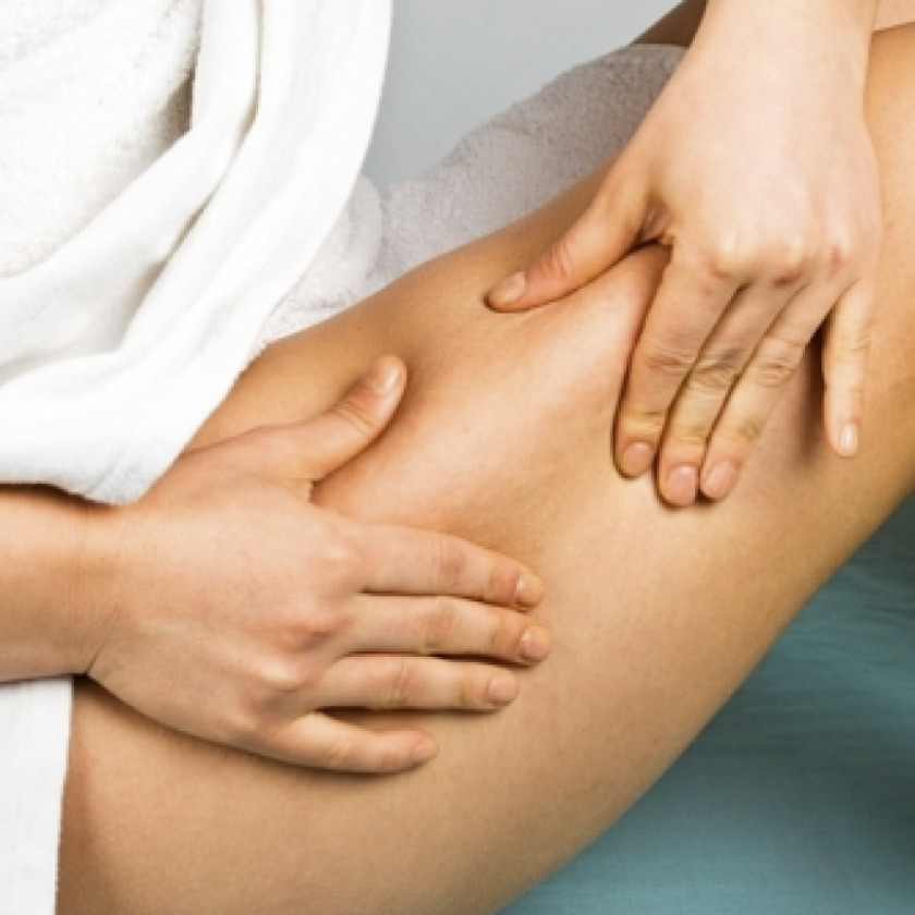 Massage Skin Cancer Symptom Stretch Marks Cellulite PNG