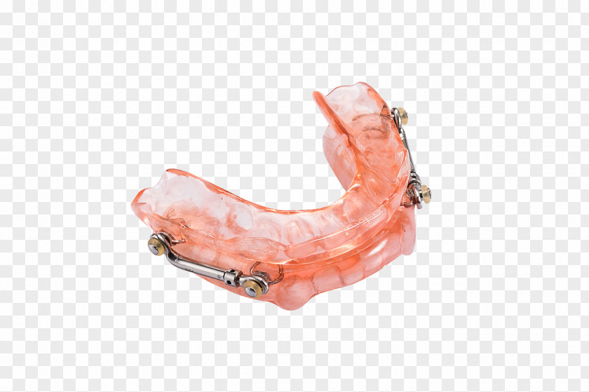 Snoring Mandibular Advancement Splint Obstructive Sleep Apnea PNG