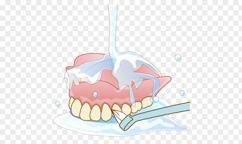 Tooth Dentures Dentist Therapy Removable Partial Denture PNG