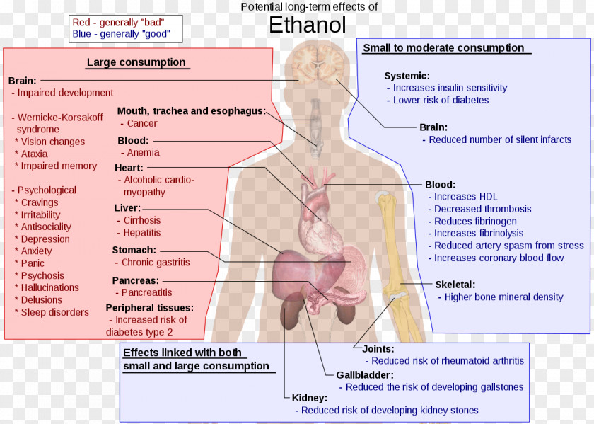 Symptoms Long-term Effects Of Alcohol Consumption Alcoholism Alcoholic Drink Ethanol And Health PNG