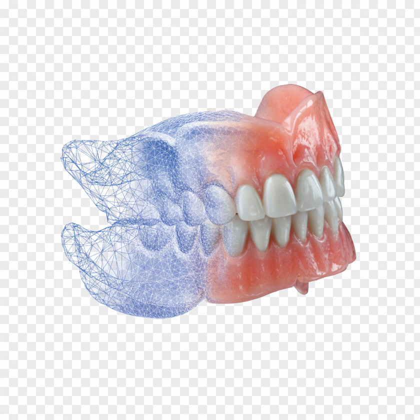 Luminous Dentures Dentistry Dental Laboratory Implant PNG