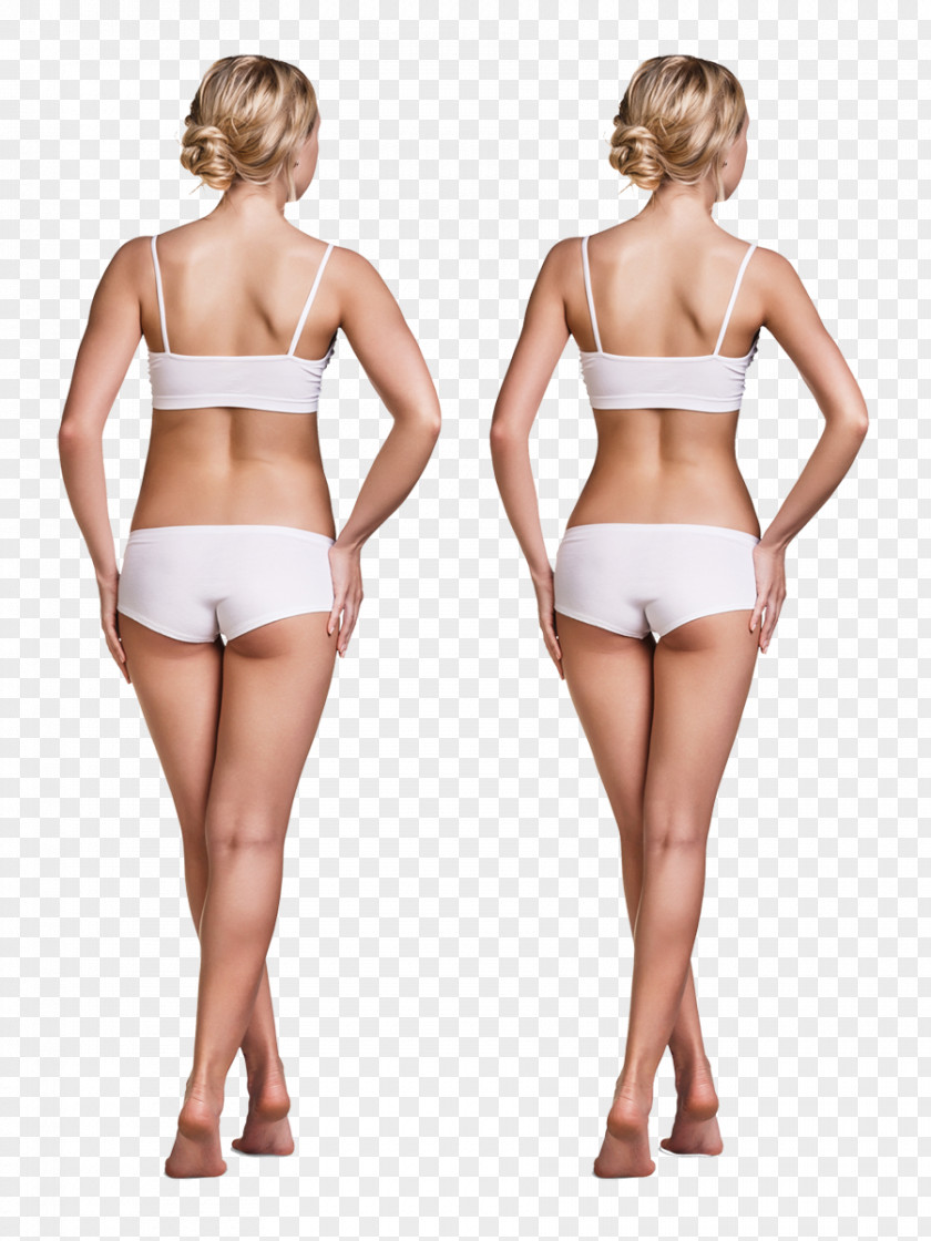 Model Weight Loss Adipose Tissue Fat Emulsification PNG