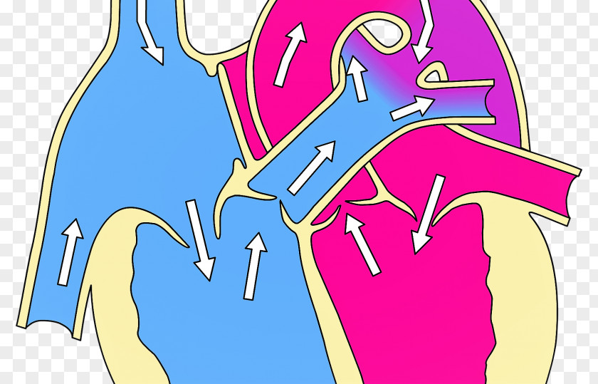 Heart Artery Anatomy Circulatory System Disease PNG