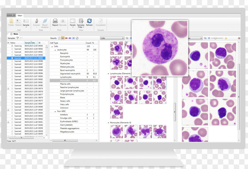 Microscope Hematology Complete Blood Count White Cell PNG