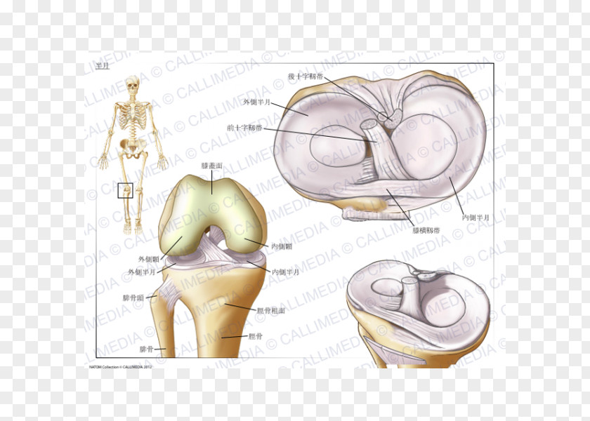Meniscus Knee Tear Of Osteoarthritis 膝関節 PNG