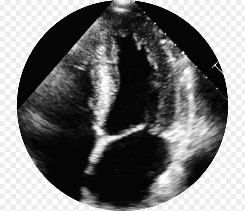 2d Ultrasound Black PNG