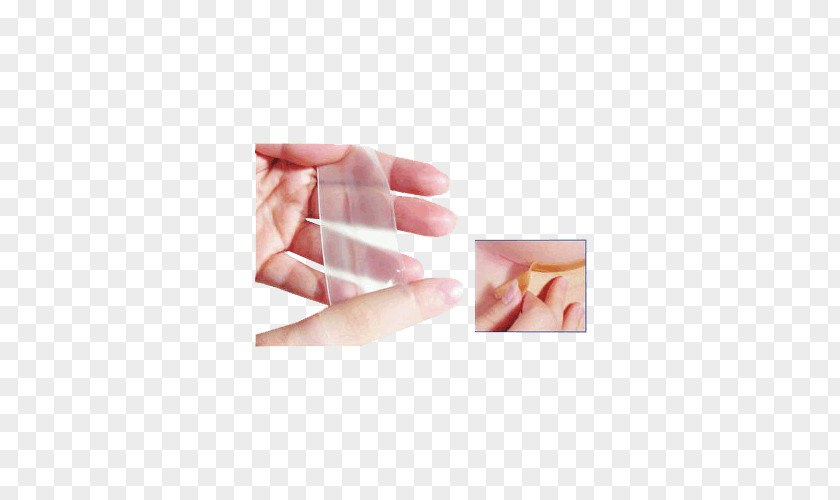 Skin Injury Hand Model Scar Finger Nail PNG