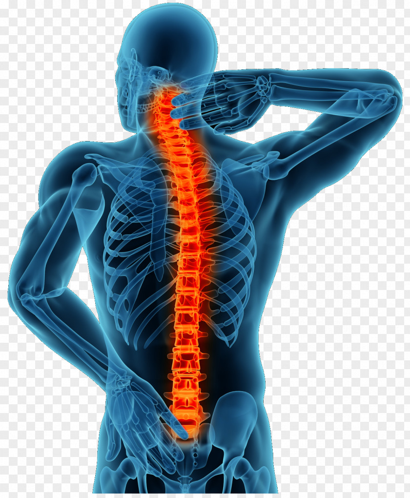 Treats Back Pain Management Therapy Spinal Disc Herniation Degenerative Disease PNG