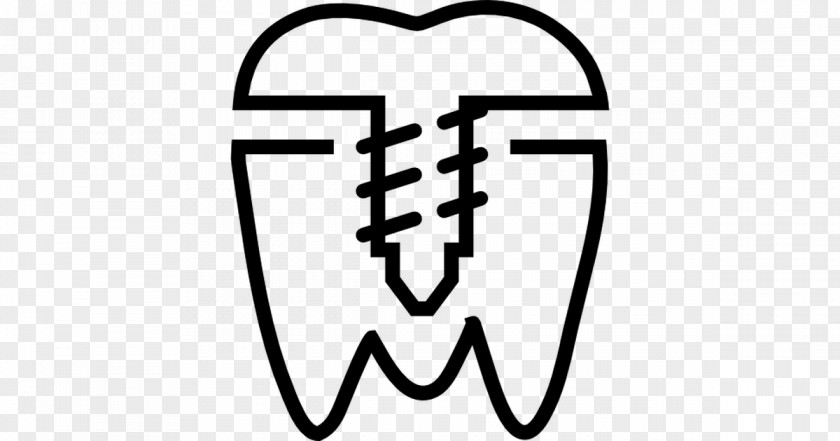 Health Dentistry Dental Implant Dentures All-on-4 PNG
