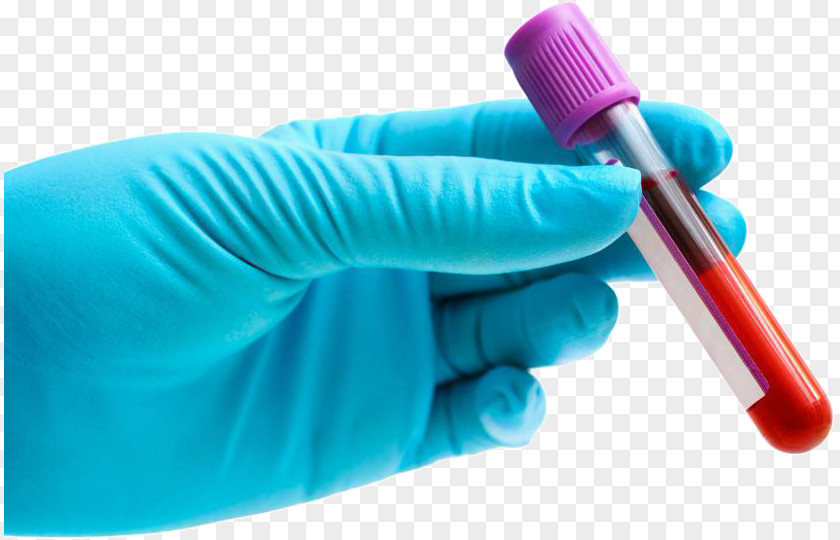 Mycoplasma Blood Test Herpes Simplex Virus Labialis Herpetic Whitlow PNG