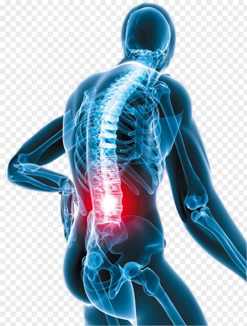 Vertebral Low Back Pain Neck Oxycodone Human PNG