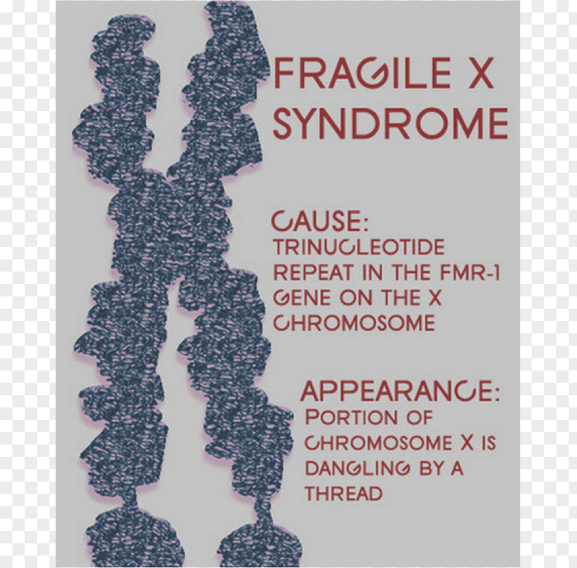 Fragile X Syndrome Intellectual Disability Genetic Disorder 22q13 Deletion PNG