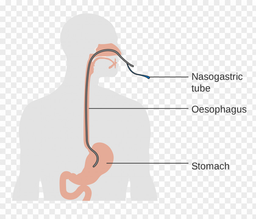 The Correct Posture Of Baby Feeding Esophagus Esophageal Cancer Human Anatomy Dysphagia Esophagectomy PNG